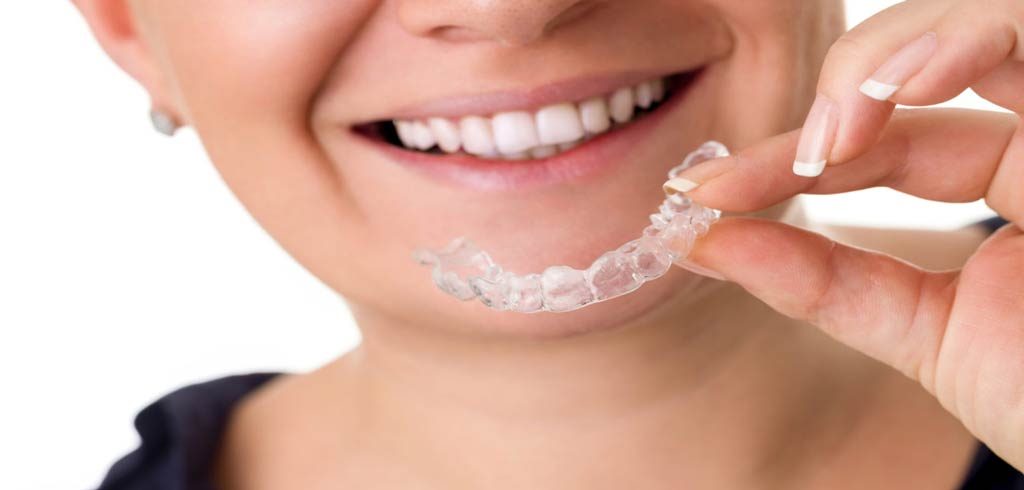 Invisible Braces in Clapham: A Clear Choice for Adults and Teens